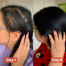 Recupera tus Cabellos y Combate la Calvicie con el Poder del Aceite de Marruecos y Oliva